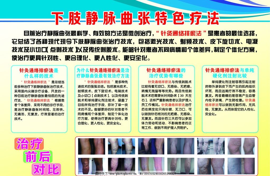静脉曲张特色疗法图片,背景 针灸通络排瘀法 治疗前后对比-图行天下图库
